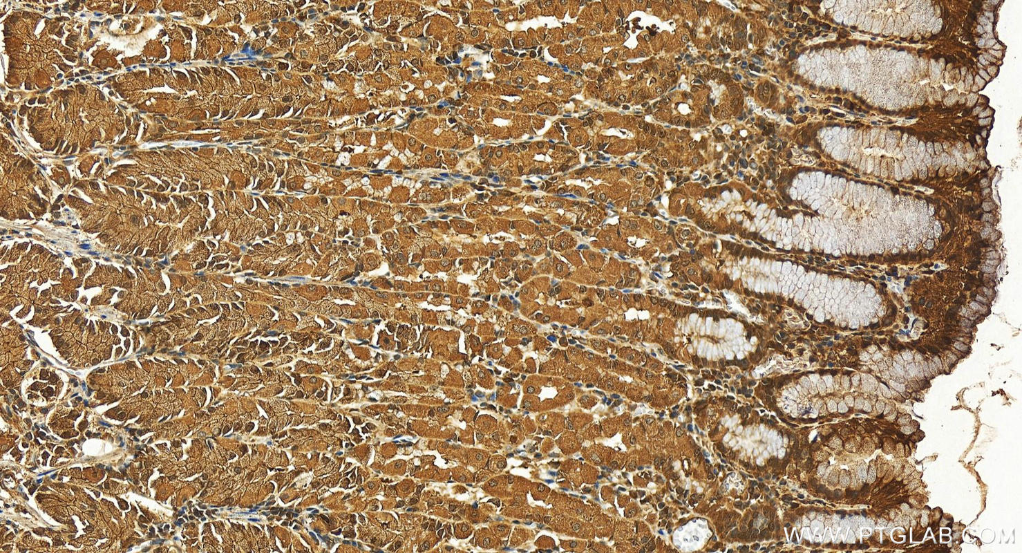 Immunohistochemistry (IHC) staining of human stomach tissue using STAT1 Polyclonal antibody (10144-2-AP)