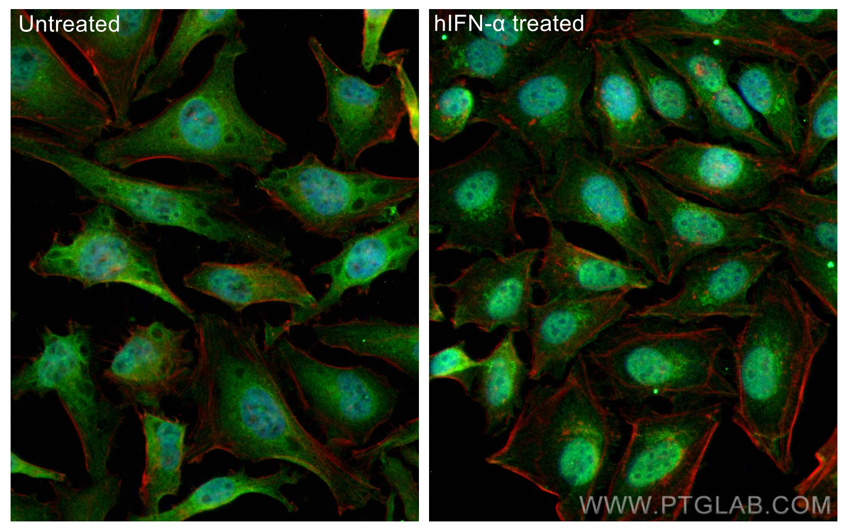 Immunofluorescence (IF) / fluorescent staining of HeLa cells using STAT1 Polyclonal antibody (10144-2-AP)