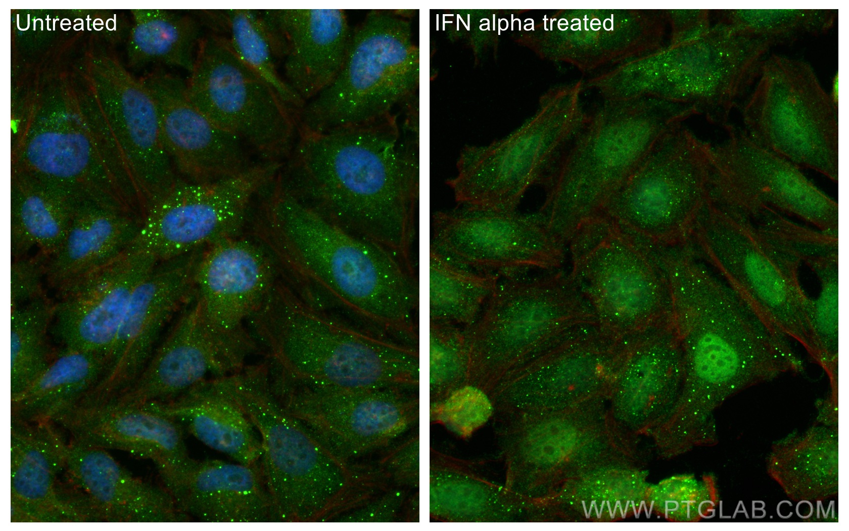 Immunofluorescence (IF) / fluorescent staining of HeLa cells using STAT1 Monoclonal antibody (66545-1-Ig)