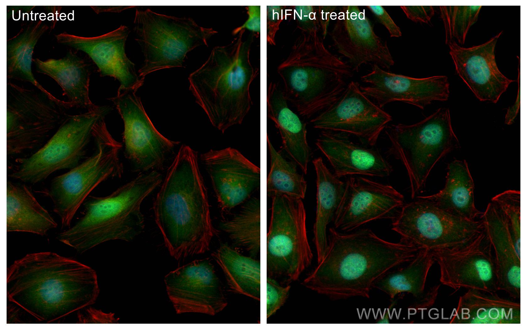 Immunofluorescence (IF) / fluorescent staining of HeLa cells using STAT1 Recombinant antibody (82016-1-RR)