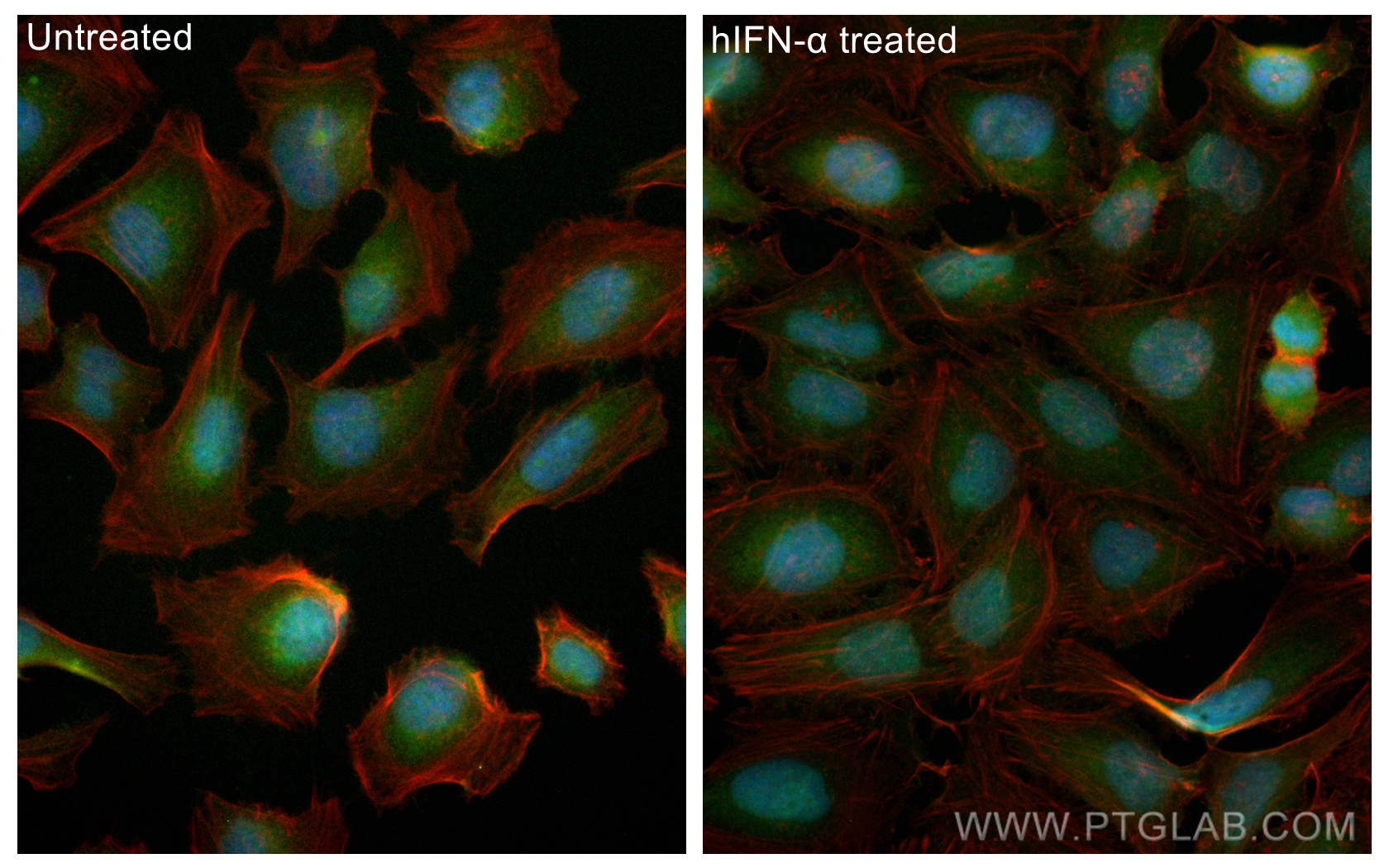 Immunofluorescence (IF) / fluorescent staining of HeLa cells using CoraLite® Plus 488-conjugated STAT1 Polyclonal ant (CL488-10144)