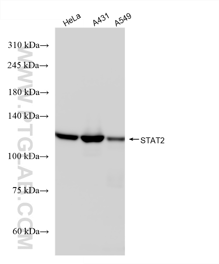 Western Blot (WB) analysis of various lysates using STAT2 Recombinant antibody (80061-5-RR)