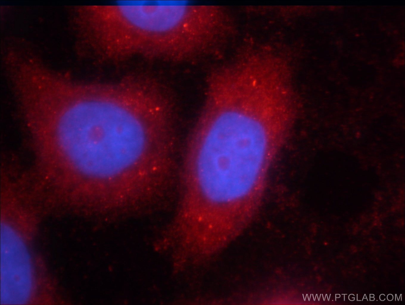 Immunofluorescent analysis of HeLa cells using STAT3 antibody