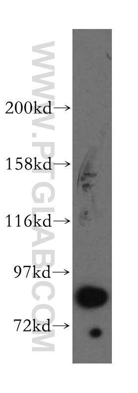 Western Blot (WB) analysis of HeLa cells using STAT3 Polyclonal antibody (51076-2-AP)