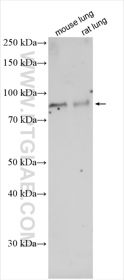 Western Blot (WB) analysis of various lysates using STAT4 Polyclonal antibody (13028-1-AP)