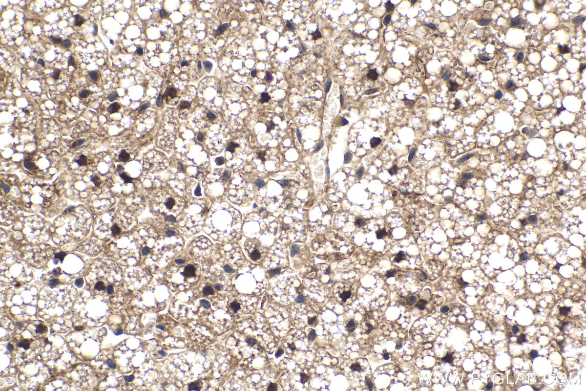 Immunohistochemistry (IHC) staining of mouse brown adipose tissue using STAT5A Monoclonal antibody (66459-1-Ig)