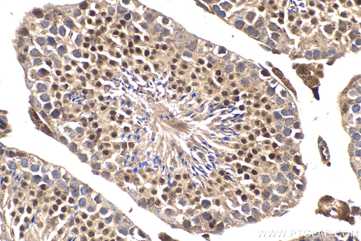Immunohistochemistry (IHC) staining of mouse testis tissue using STAT5A Monoclonal antibody (66459-1-Ig)