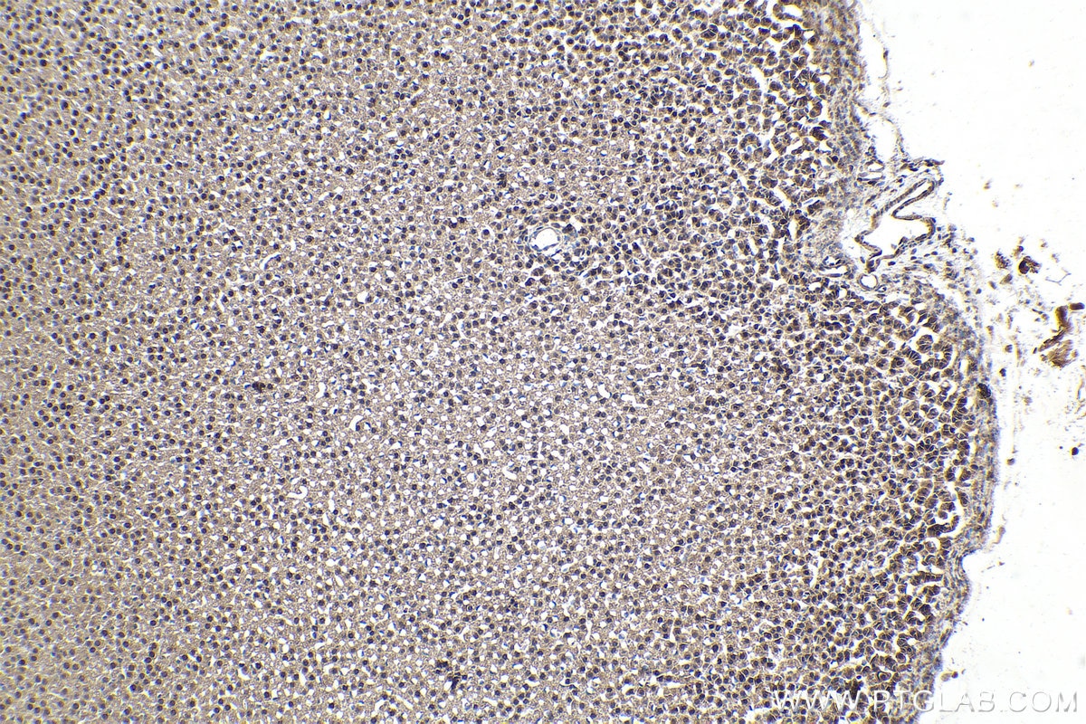 Immunohistochemistry (IHC) staining of rat adrenal gland tissue using STAT5A Monoclonal antibody (66459-1-Ig)