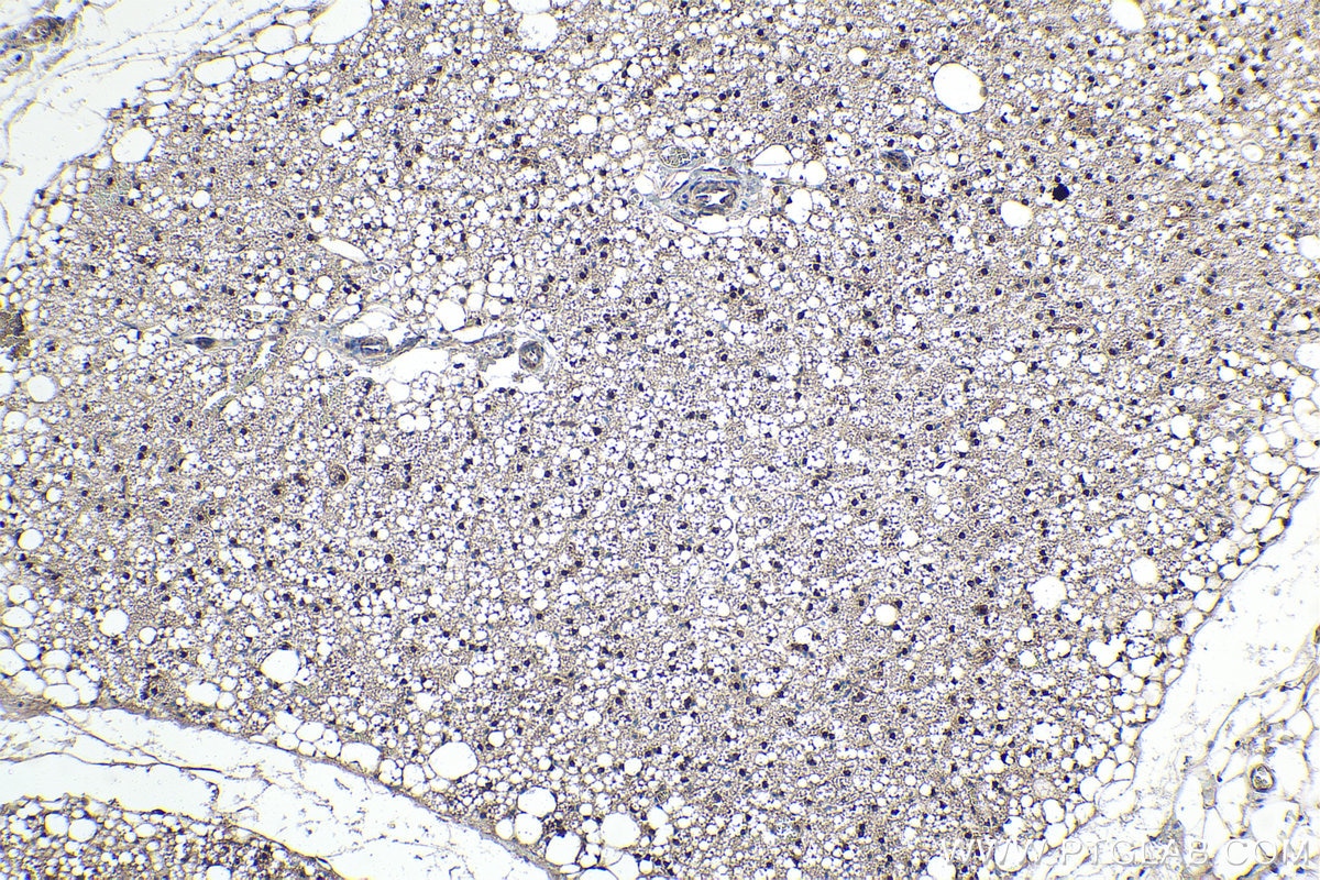 Immunohistochemistry (IHC) staining of rat brown adipose tissue using STAT5A Monoclonal antibody (66459-1-Ig)