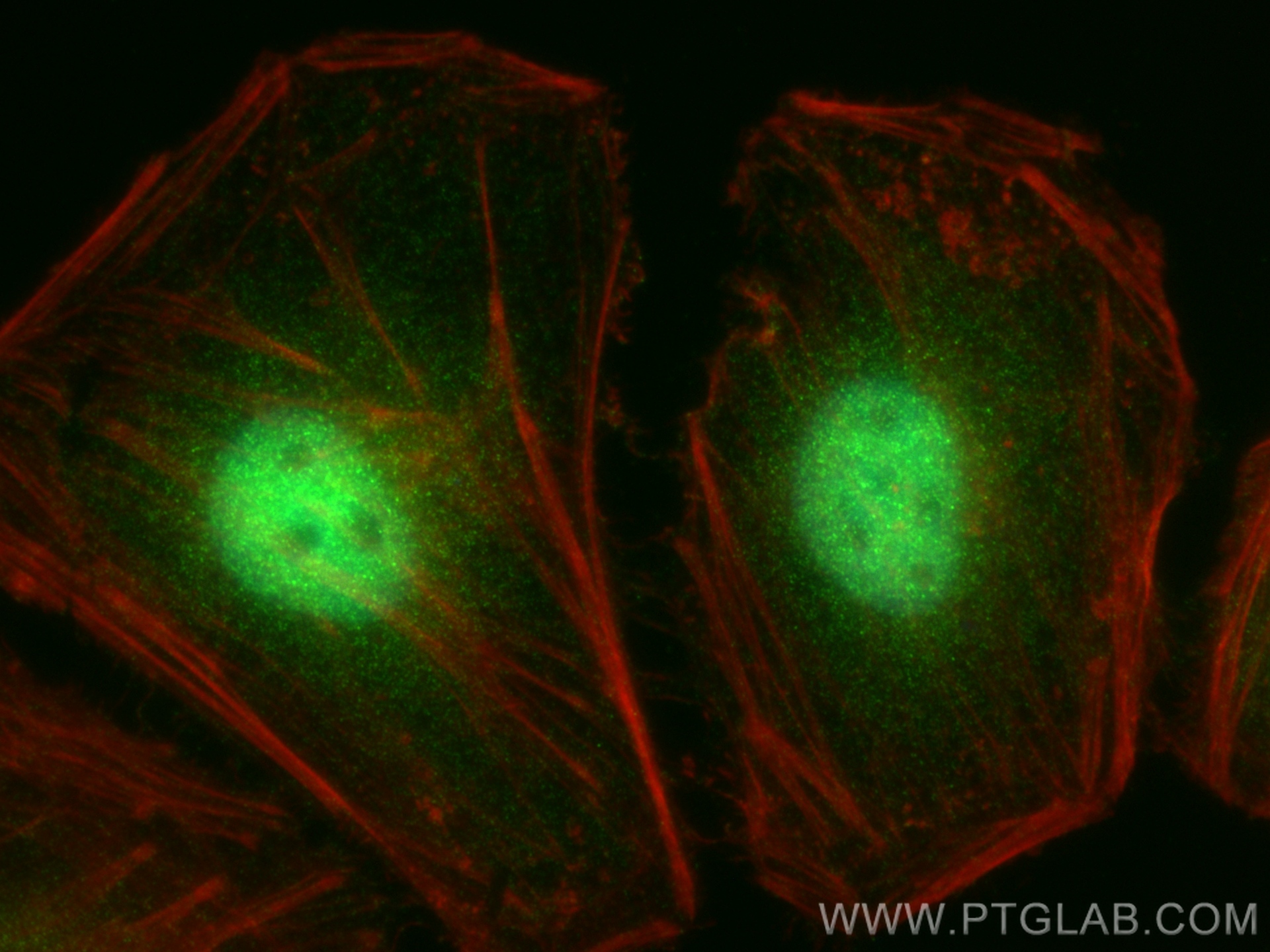 Immunofluorescence (IF) / fluorescent staining of HeLa cells using STAT5B Monoclonal antibody (66427-1-Ig)