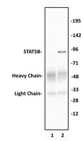 STAT5B antibody (pAb) tested by Immunoprecipitation. 10 ug of STAT5B antibody was used to immunoprecipitate STAT5B from 400 ug of K562 cytosolic cell extract (lane 2). 10 ul of rabbit IgG was used as a negative control (lane 1). The immunoprecipitated protein was detected by Western blotting using the STAT5B antibody at a dilution of 1 ug/ml.