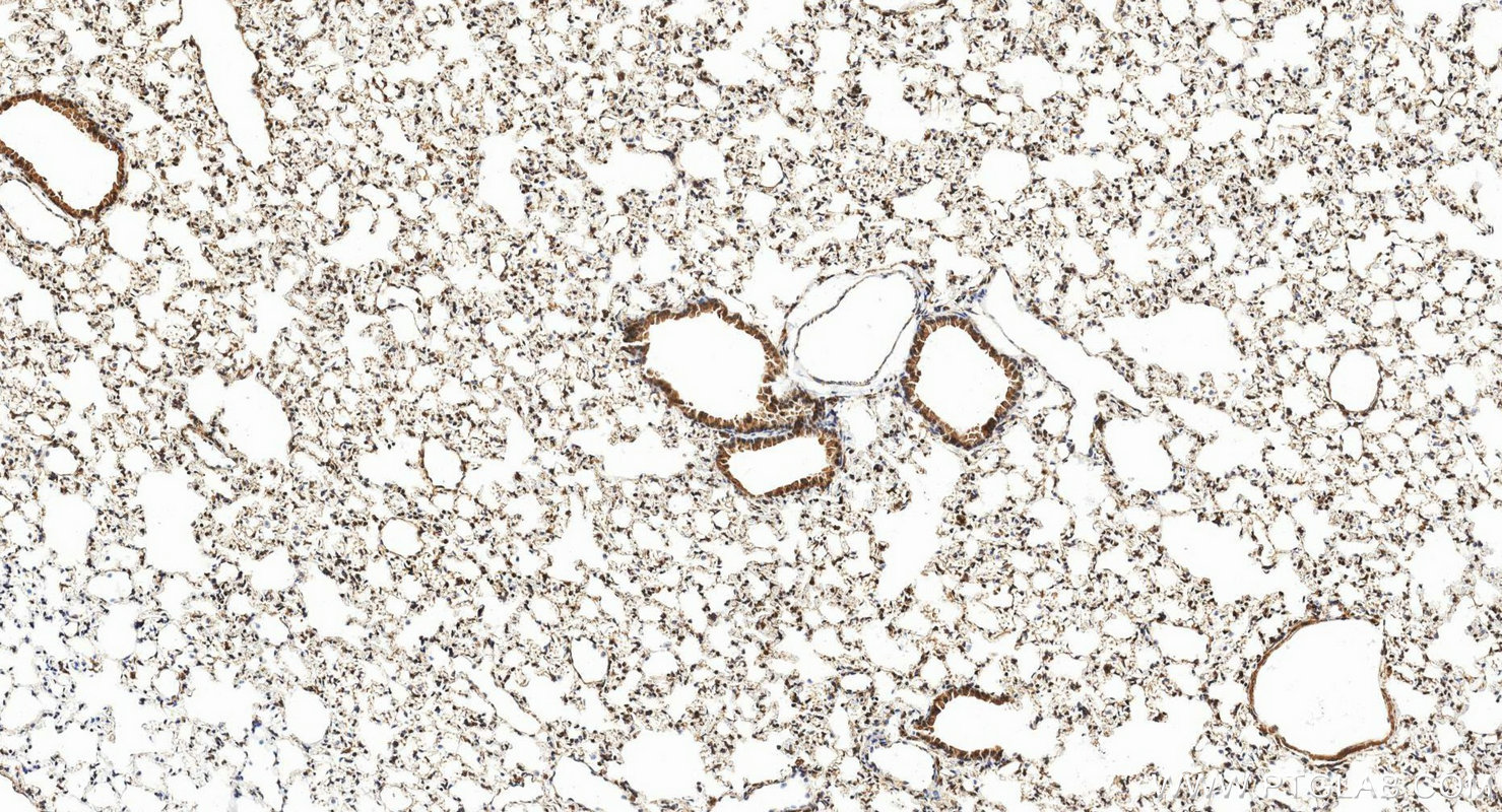 Immunohistochemistry (IHC) staining of mouse lung tissue using STAT6 Polyclonal antibody (51073-1-AP)