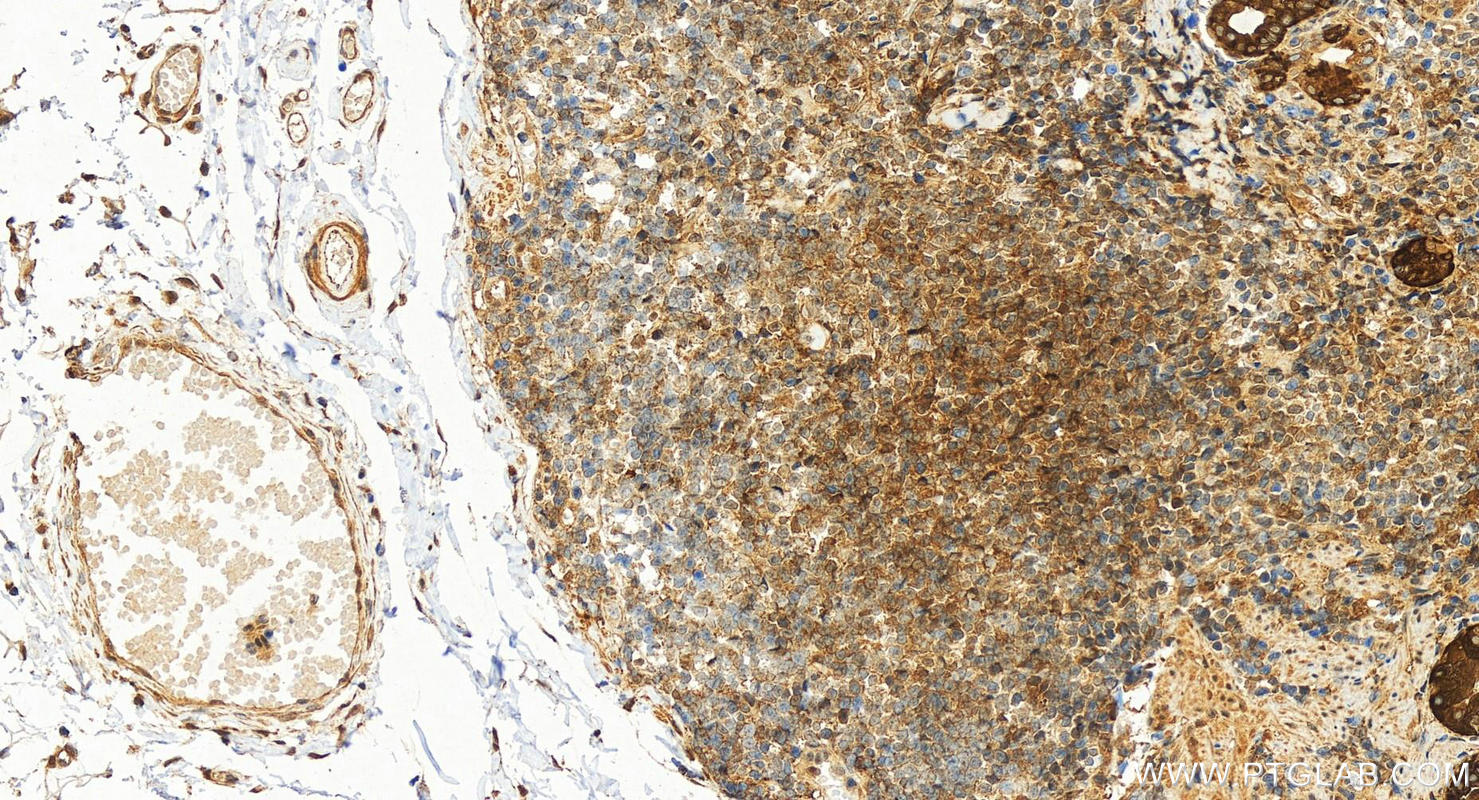 Immunohistochemistry (IHC) staining of human stomach tissue using STAT6 Recombinant antibody (82630-1-RR)