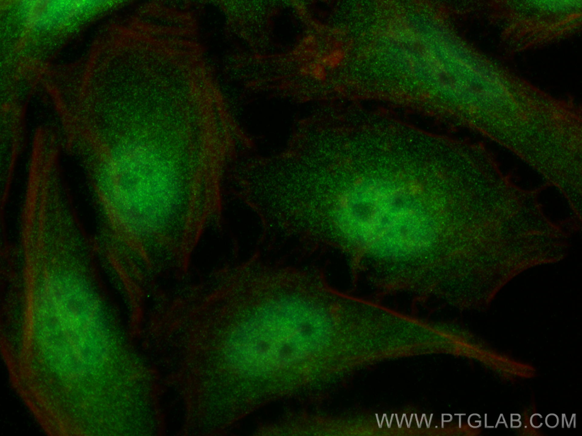 Immunofluorescence (IF) / fluorescent staining of HeLa cells using STAT6 Recombinant antibody (82630-1-RR)