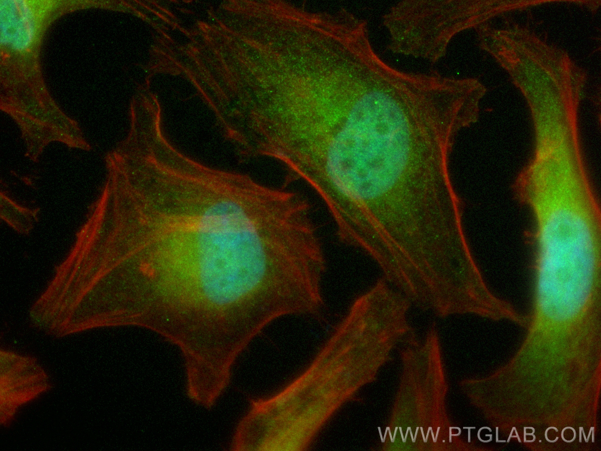 Immunofluorescence (IF) / fluorescent staining of HeLa cells using CoraLite® Plus 488-conjugated STAT6 Recombinant an (CL488-82630)