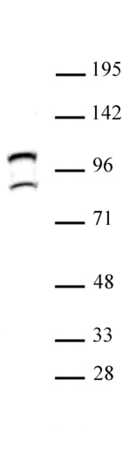 STAT6 antibody (pAb) tested by Western blot. STAT6 detection by Western blot. The analysis was performed using 30 ug Raji cytoplasmic cell extract and STAT6 antibody at a 1:500 dilution. This antibody detects two isoforms of STAT6.