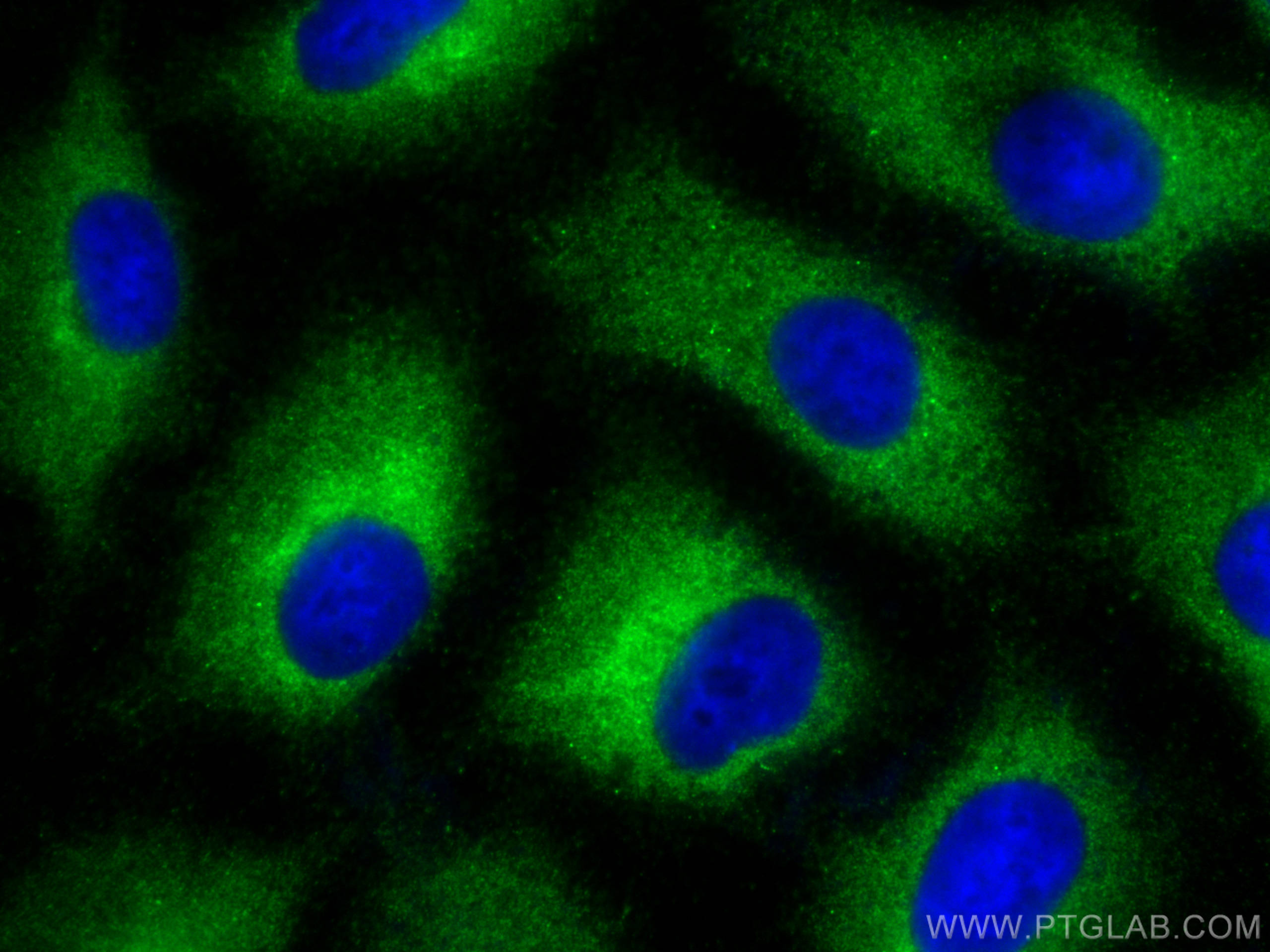 Immunofluorescence (IF) / fluorescent staining of A549 cells using STAU1 Polyclonal antibody (14225-1-AP)