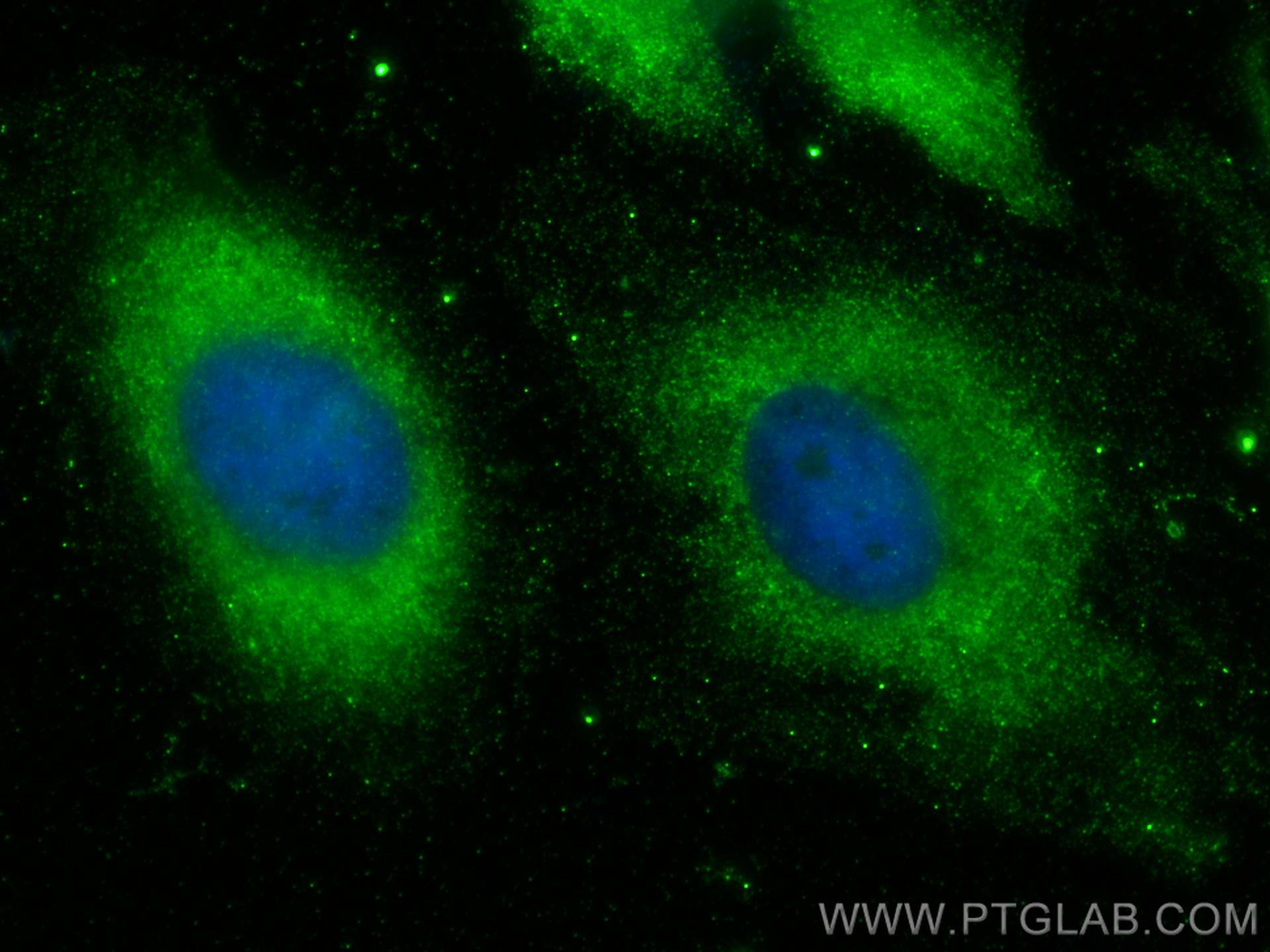 Immunofluorescence (IF) / fluorescent staining of HeLa cells using STBD1 Monoclonal antibody (67018-1-Ig)