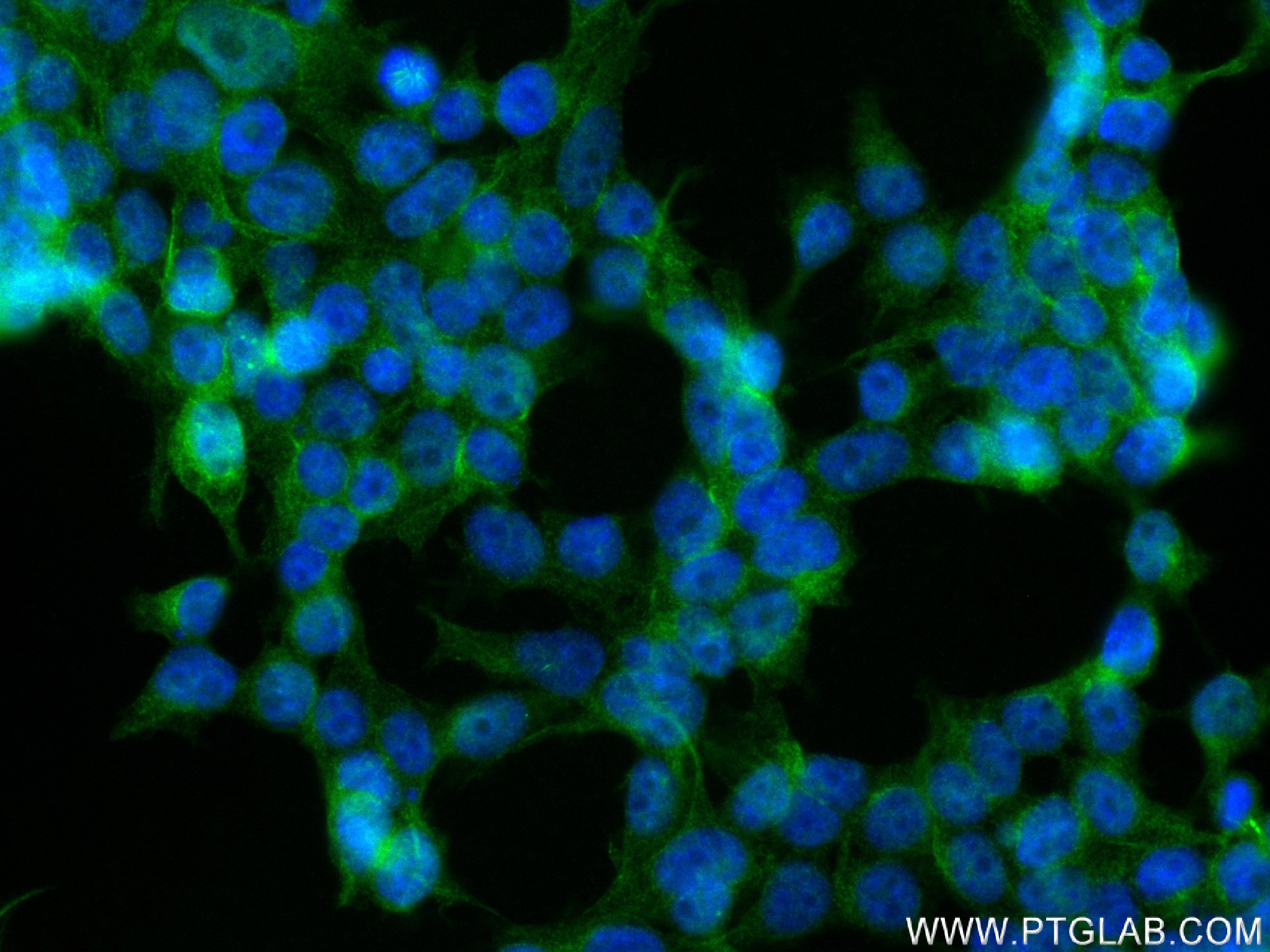 Immunofluorescence (IF) / fluorescent staining of HEK-293 cells using STEAP2 Recombinant antibody (83611-3-RR)