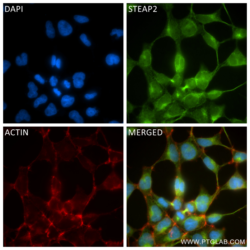 Immunofluorescence (IF) / fluorescent staining of HEK-293 cells using STEAP2 Recombinant antibody (83611-3-RR)