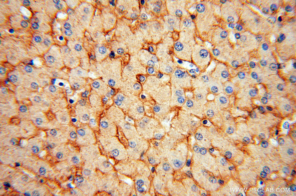 Immunohistochemistry (IHC) staining of human liver tissue using STEAP3 Polyclonal antibody (17186-1-AP)