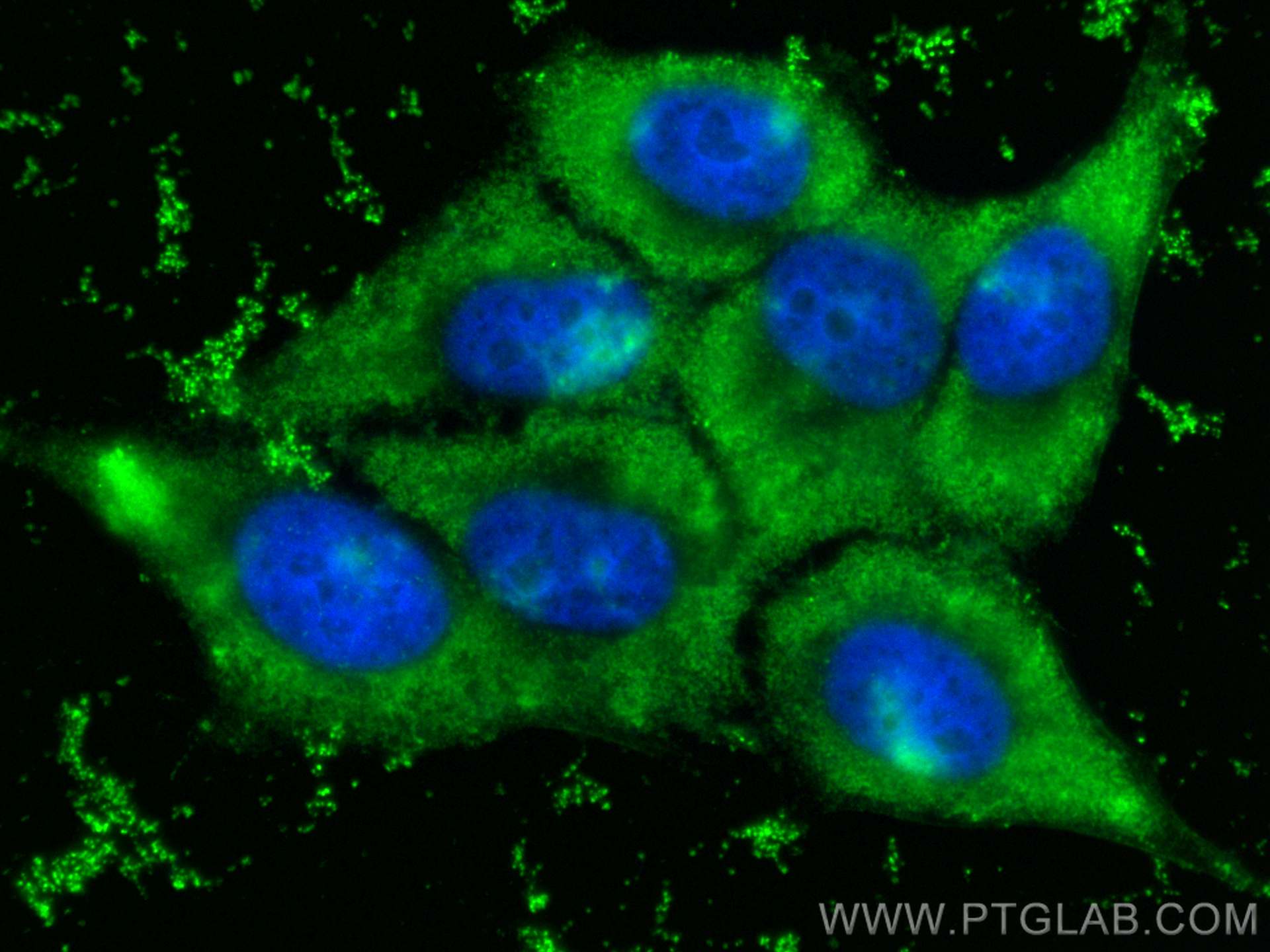 Immunofluorescence (IF) / fluorescent staining of HepG2 cells using STEAP3 Polyclonal antibody (28478-1-AP)