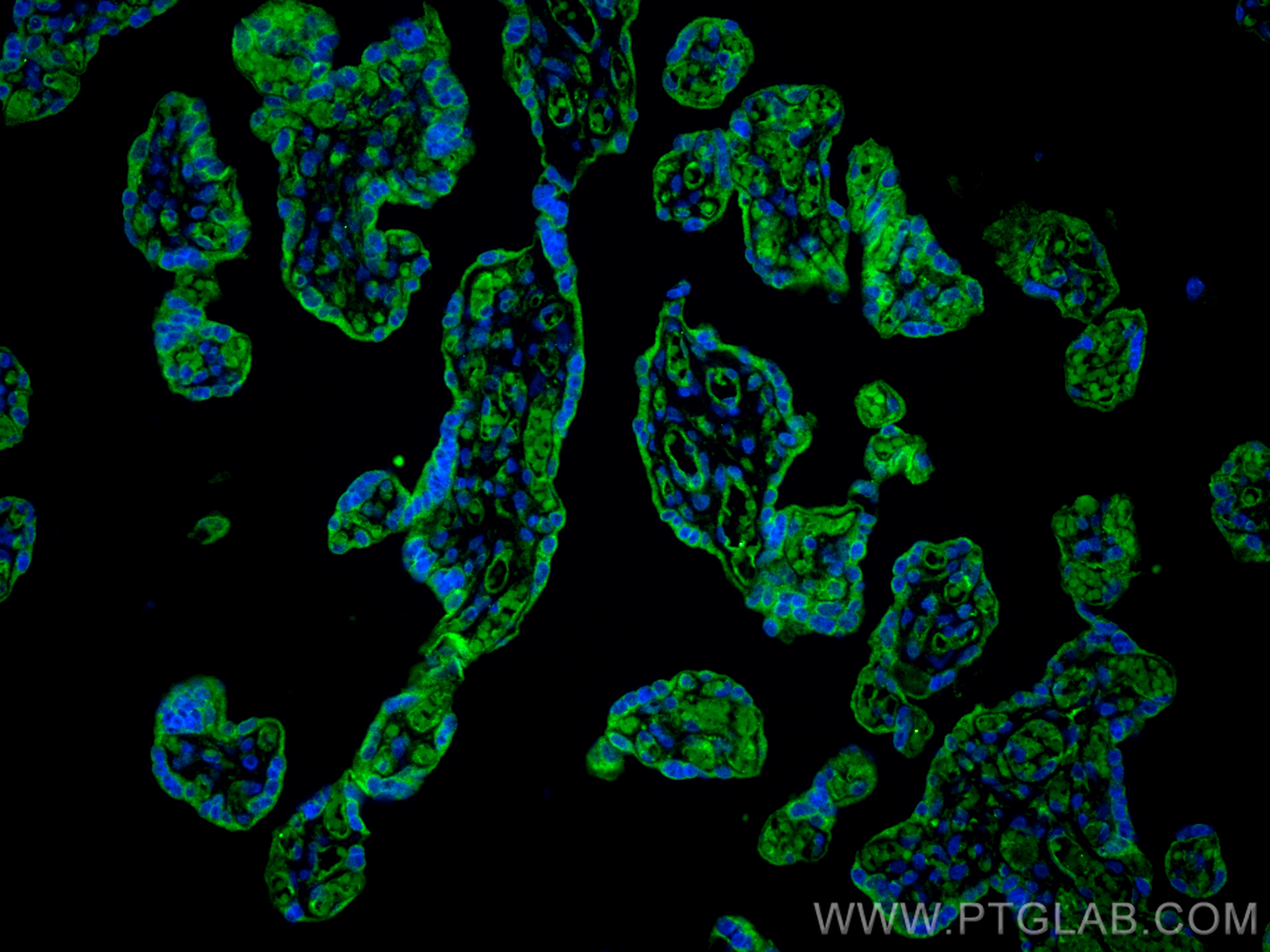 Immunofluorescence (IF) / fluorescent staining of human placenta tissue using STEAP4 Polyclonal antibody (11944-1-AP)