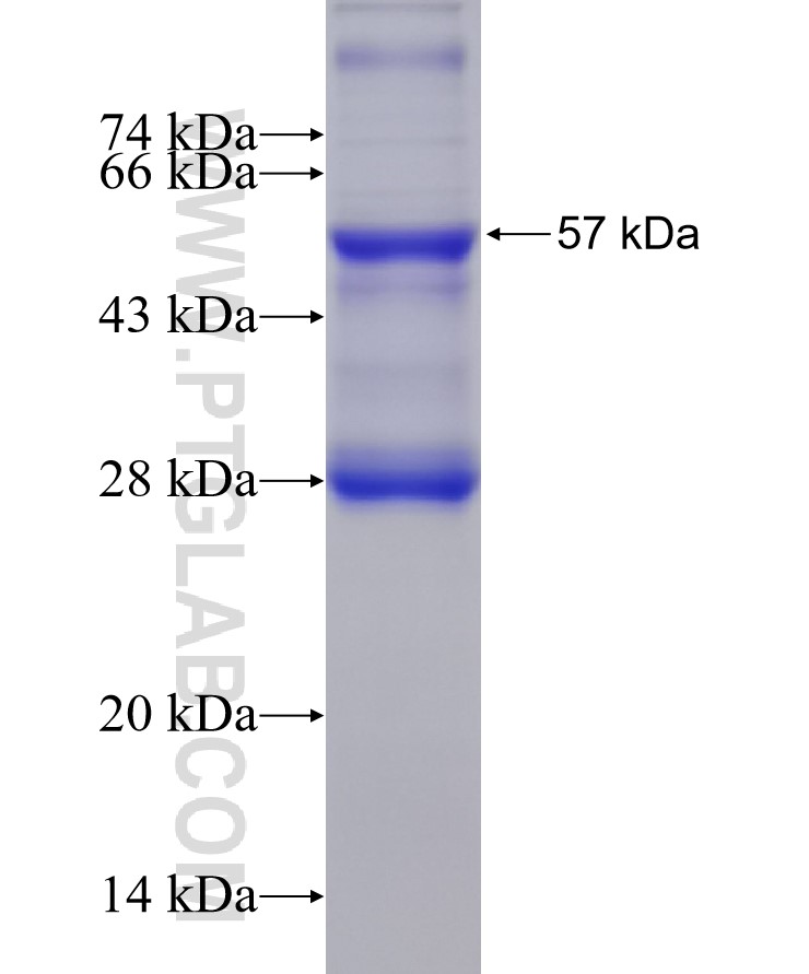 STEAP4 fusion protein Ag28030 SDS-PAGE