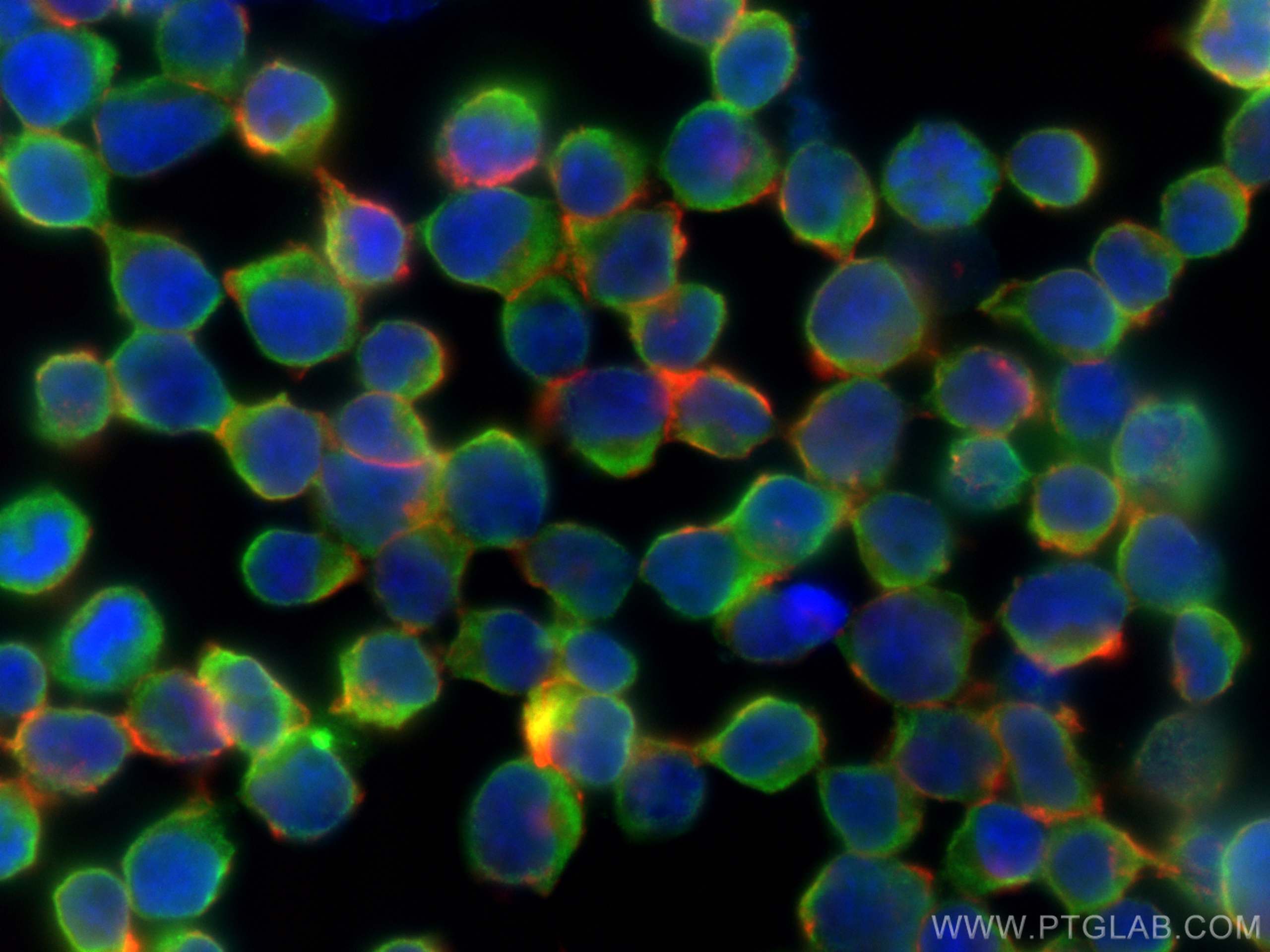 Immunofluorescence (IF) / fluorescent staining of Jurkat cells using STIL Monoclonal antibody (66876-1-Ig)