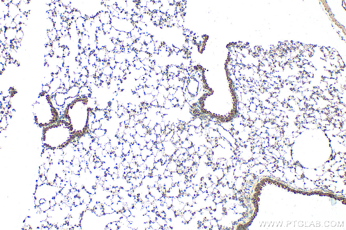 Immunohistochemistry (IHC) staining of mouse lung tissue using STIM1 Polyclonal antibody (11565-1-AP)