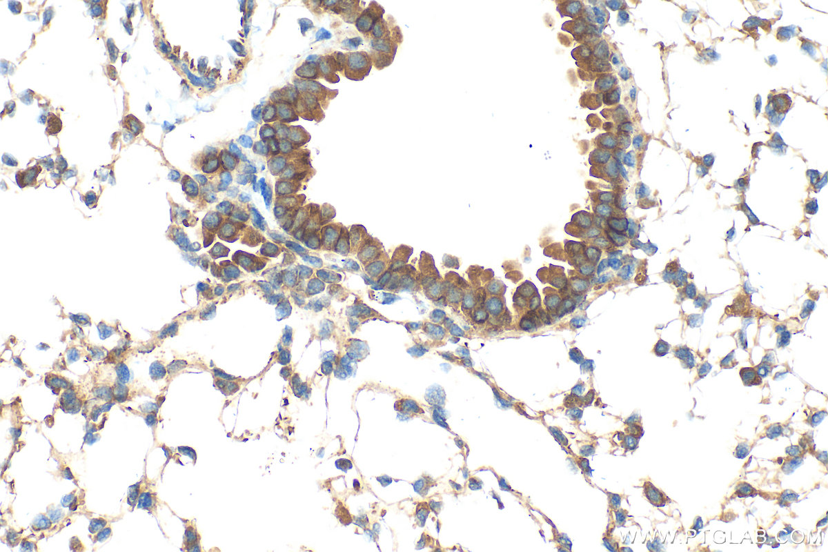 Immunohistochemistry (IHC) staining of mouse lung tissue using STIM1 Polyclonal antibody (11565-1-AP)