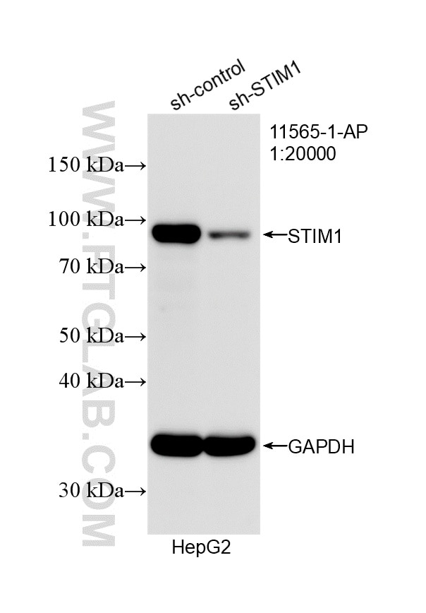 Western Blot (WB) analysis of HepG2 cells using STIM1 Polyclonal antibody (11565-1-AP)