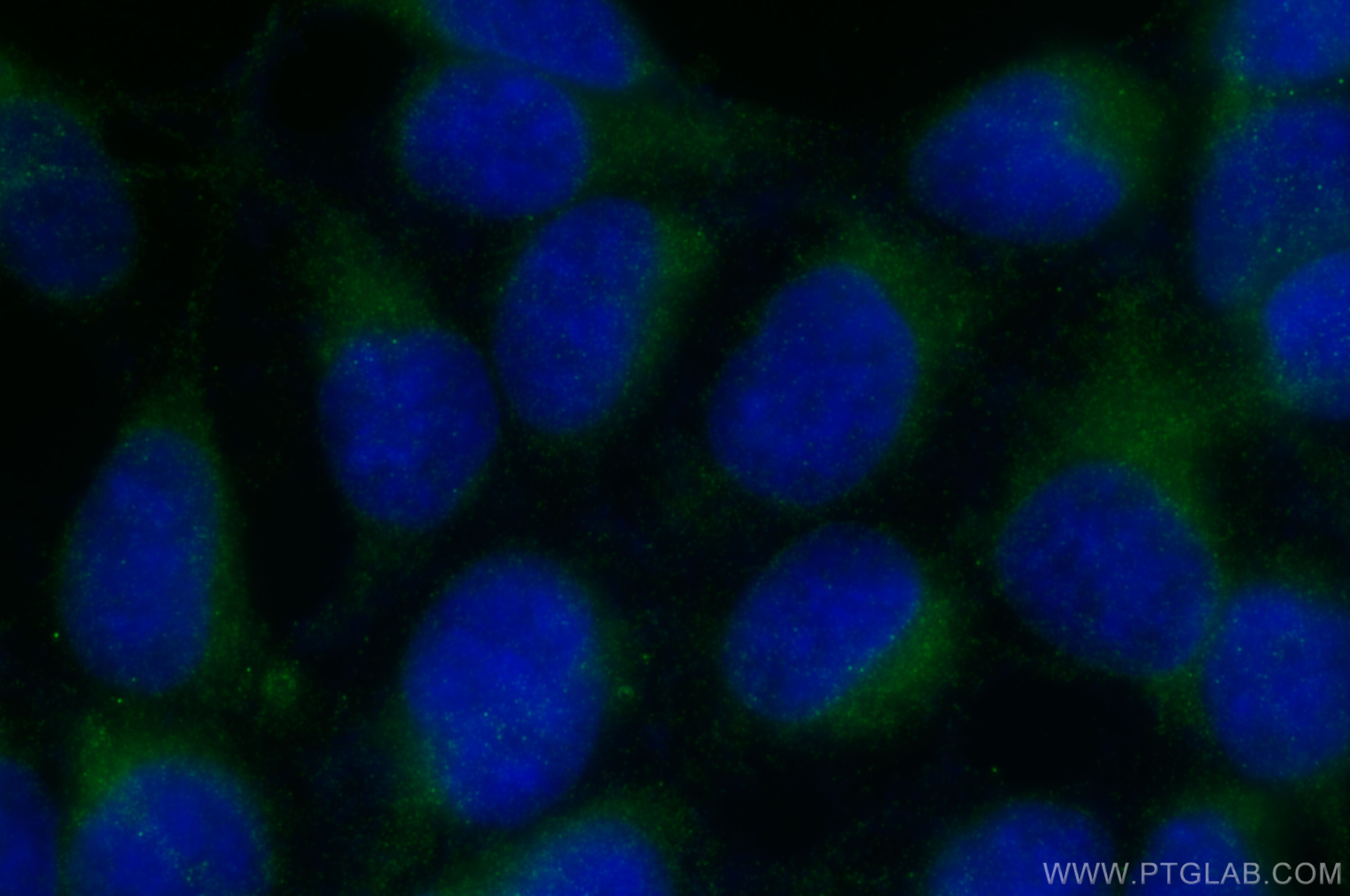 Immunofluorescence (IF) / fluorescent staining of HEK-293 cells using STIM1 Recombinant antibody (81156-1-RR)