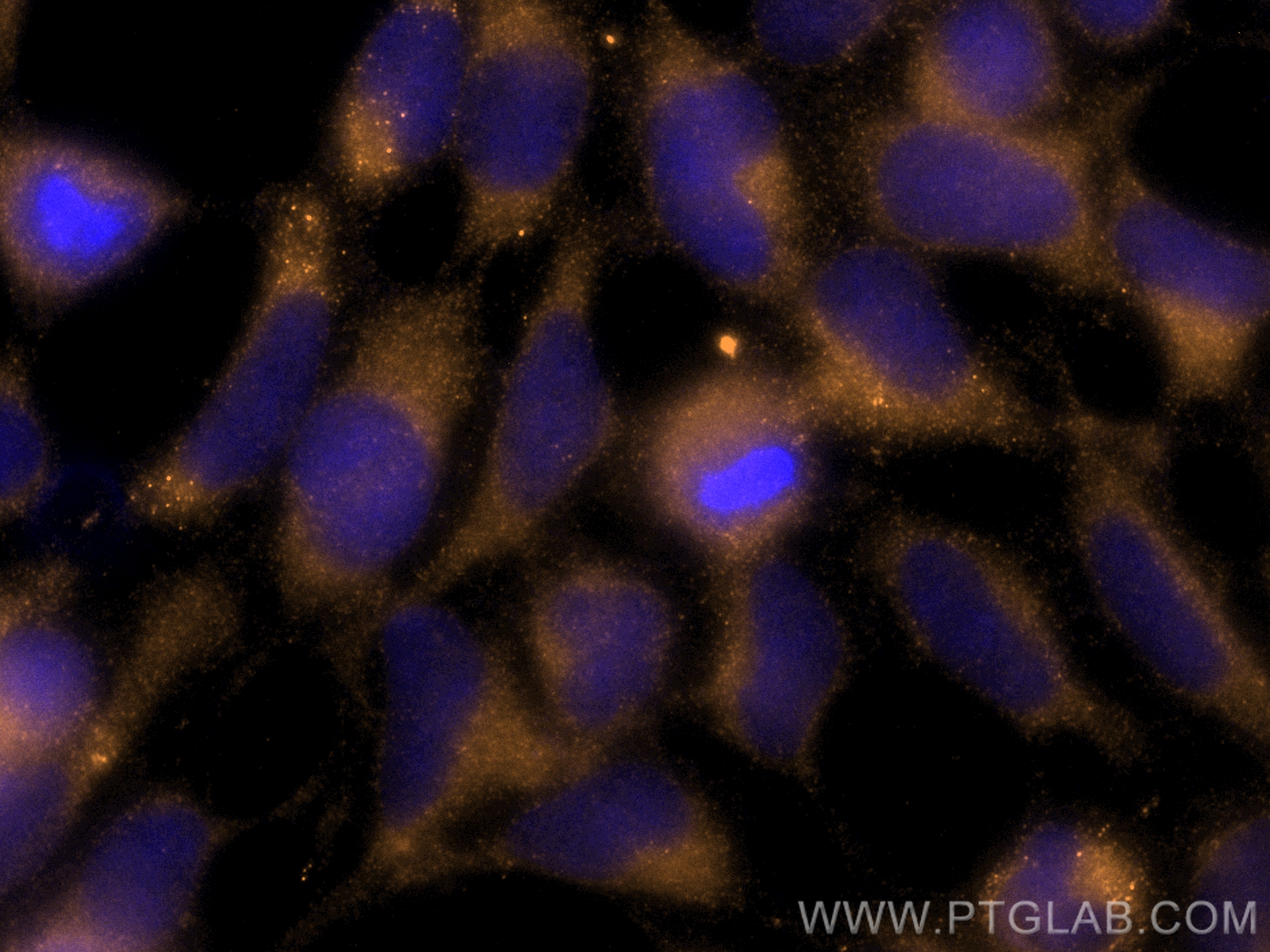 Immunofluorescence (IF) / fluorescent staining of HEK-293 cells using CoraLite® Plus 555-conjugated STIM1 Polyclonal ant (CL555-11565)