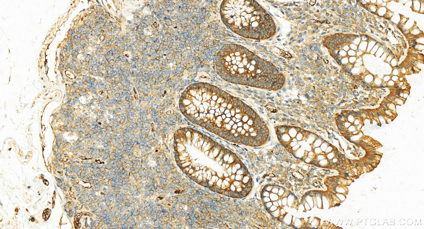 Immunohistochemistry (IHC) staining of human normal colon using STIP1 Polyclonal antibody (15218-1-AP)