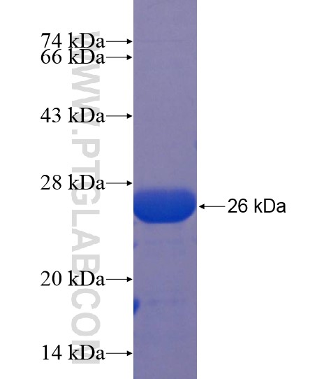 STK10 fusion protein Ag22237 SDS-PAGE