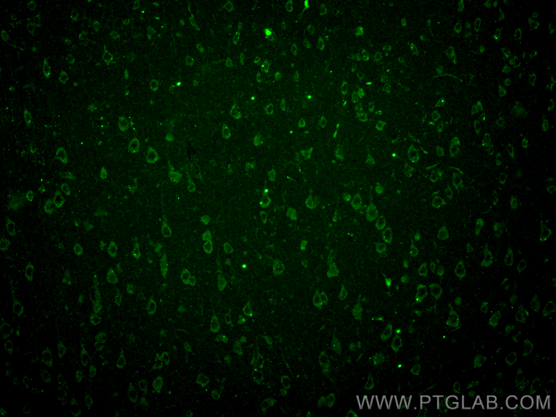 Immunofluorescence (IF) / fluorescent staining of rat brain tissue using STK24 Monoclonal antibody (68522-1-Ig)