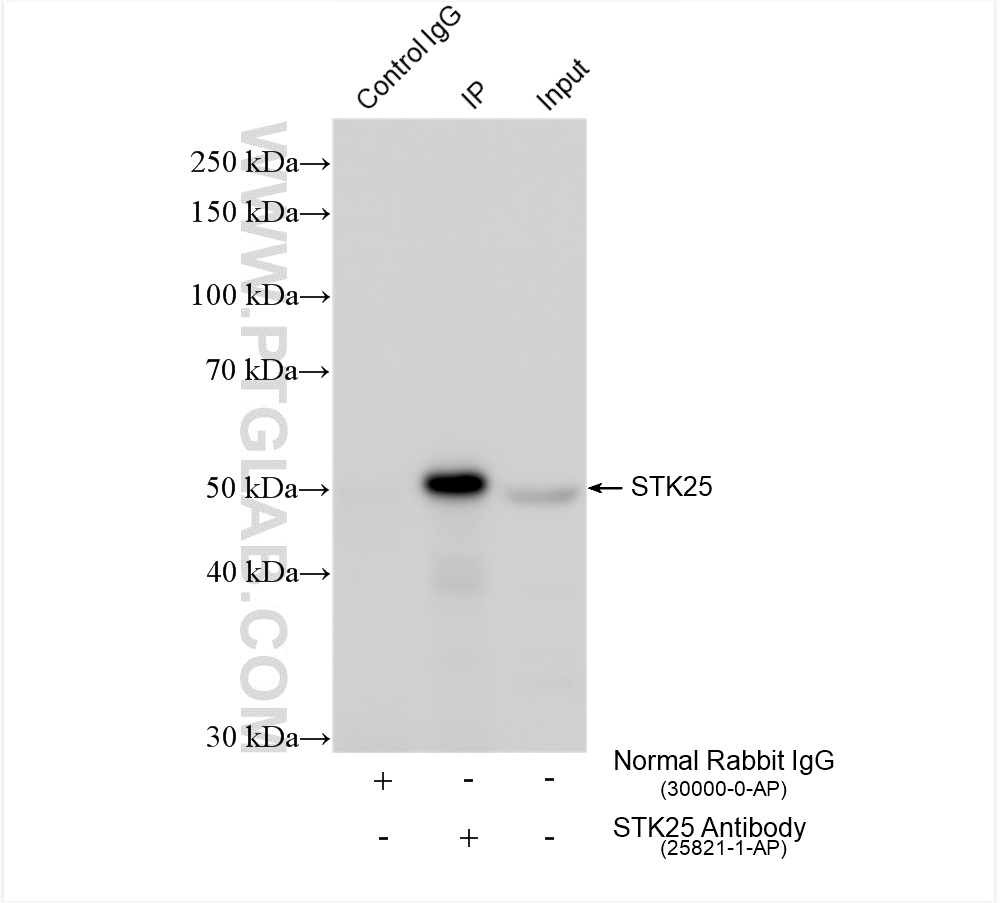 Immunoprecipitation (IP) experiment of mouse brain tissue using STK25 Polyclonal antibody (25821-1-AP)