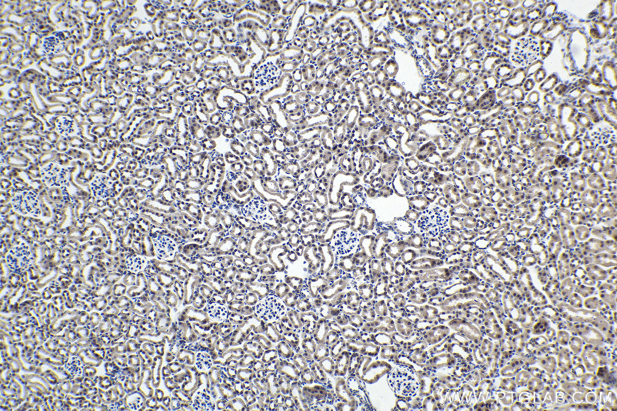 Immunohistochemistry (IHC) staining of mouse kidney tissue using STK3 Monoclonal antibody (66637-1-Ig)