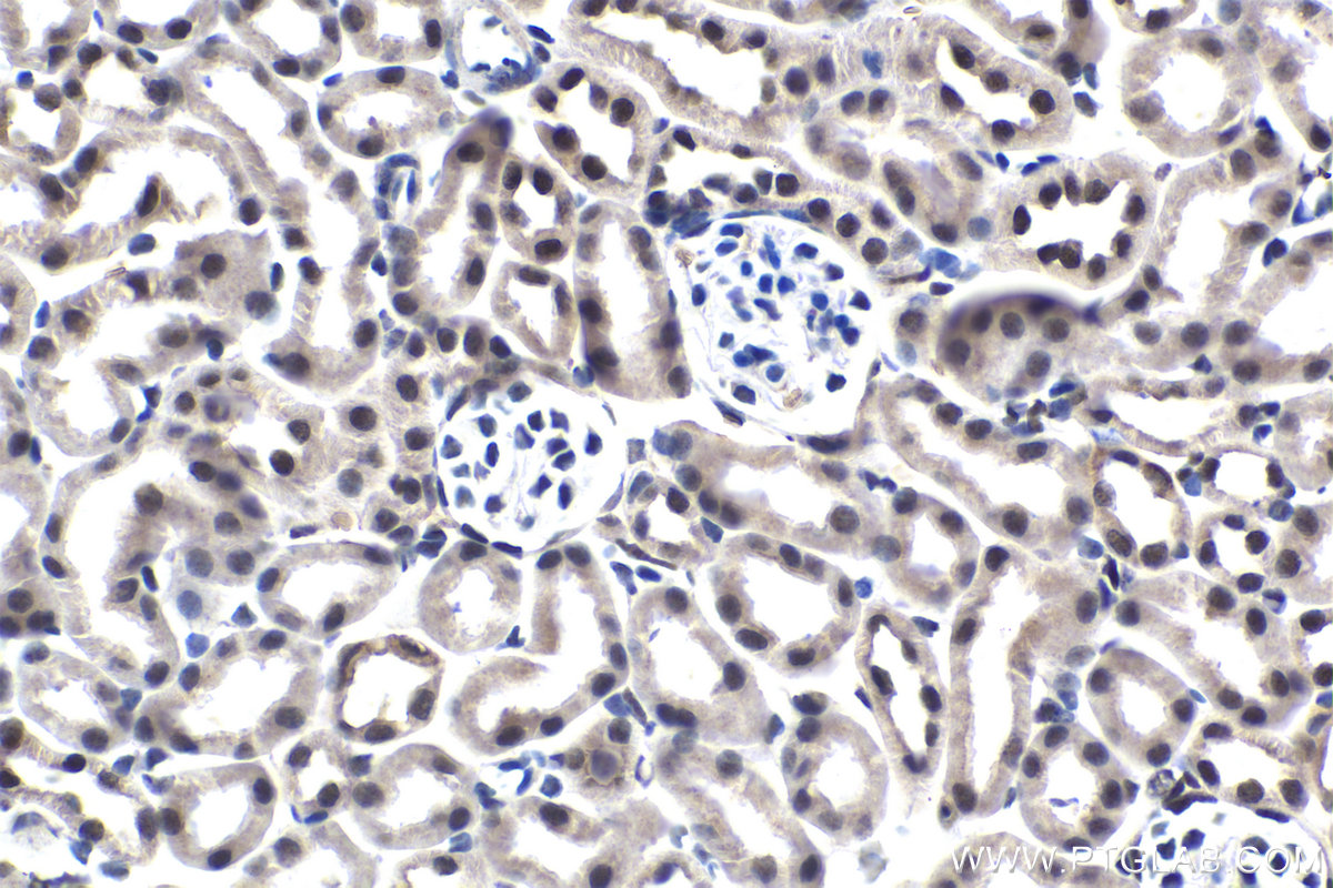 Immunohistochemistry (IHC) staining of mouse kidney tissue using STK3 Monoclonal antibody (66637-1-Ig)