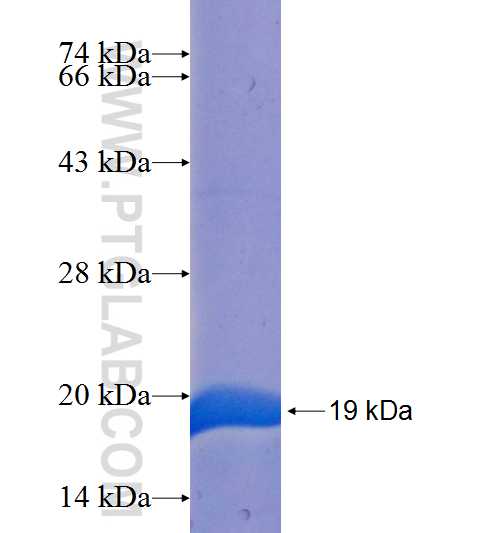 STK35 fusion protein Ag25250 SDS-PAGE