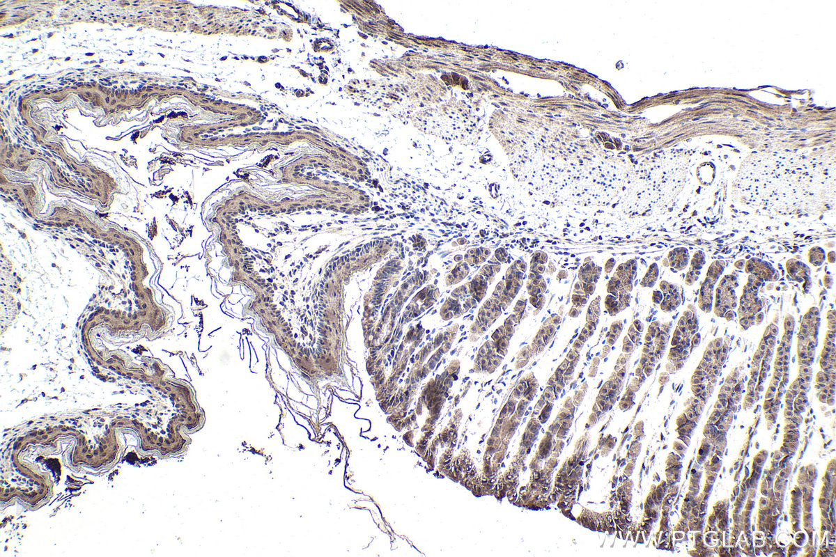 Immunohistochemistry (IHC) staining of mouse stomach tissue using STK36 Polyclonal antibody (12559-1-AP)