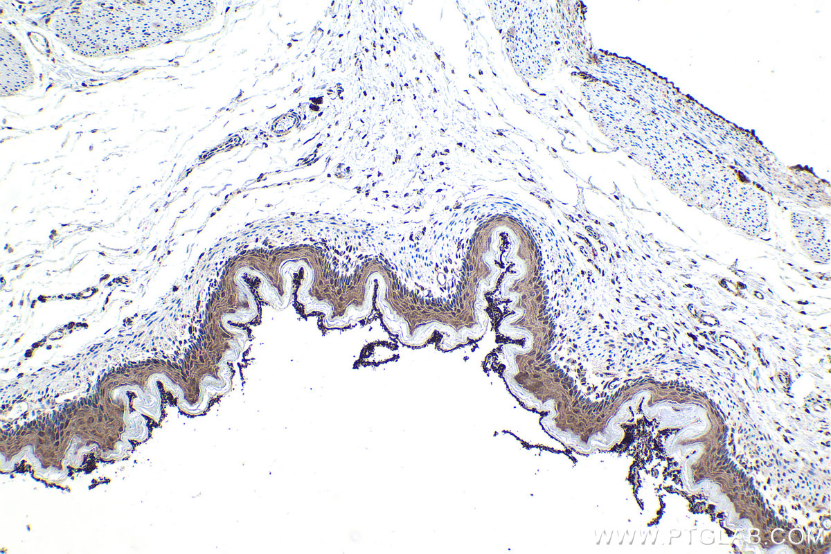 Immunohistochemistry (IHC) staining of rat stomach tissue using STK36 Polyclonal antibody (12559-1-AP)