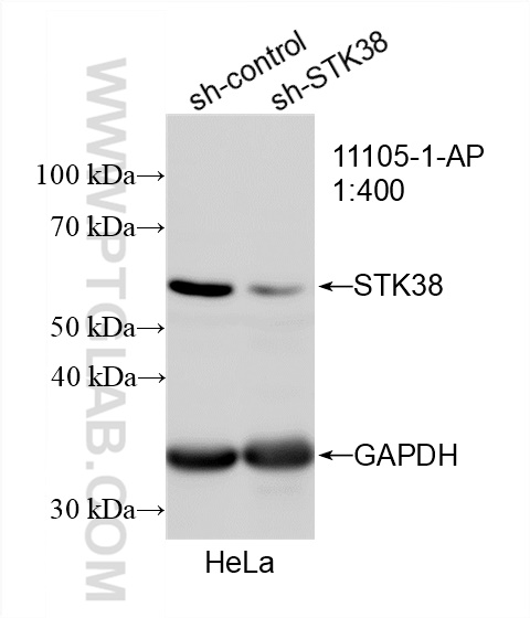 Western Blot (WB) analysis of HeLa cells using STK38 Polyclonal antibody (11105-1-AP)