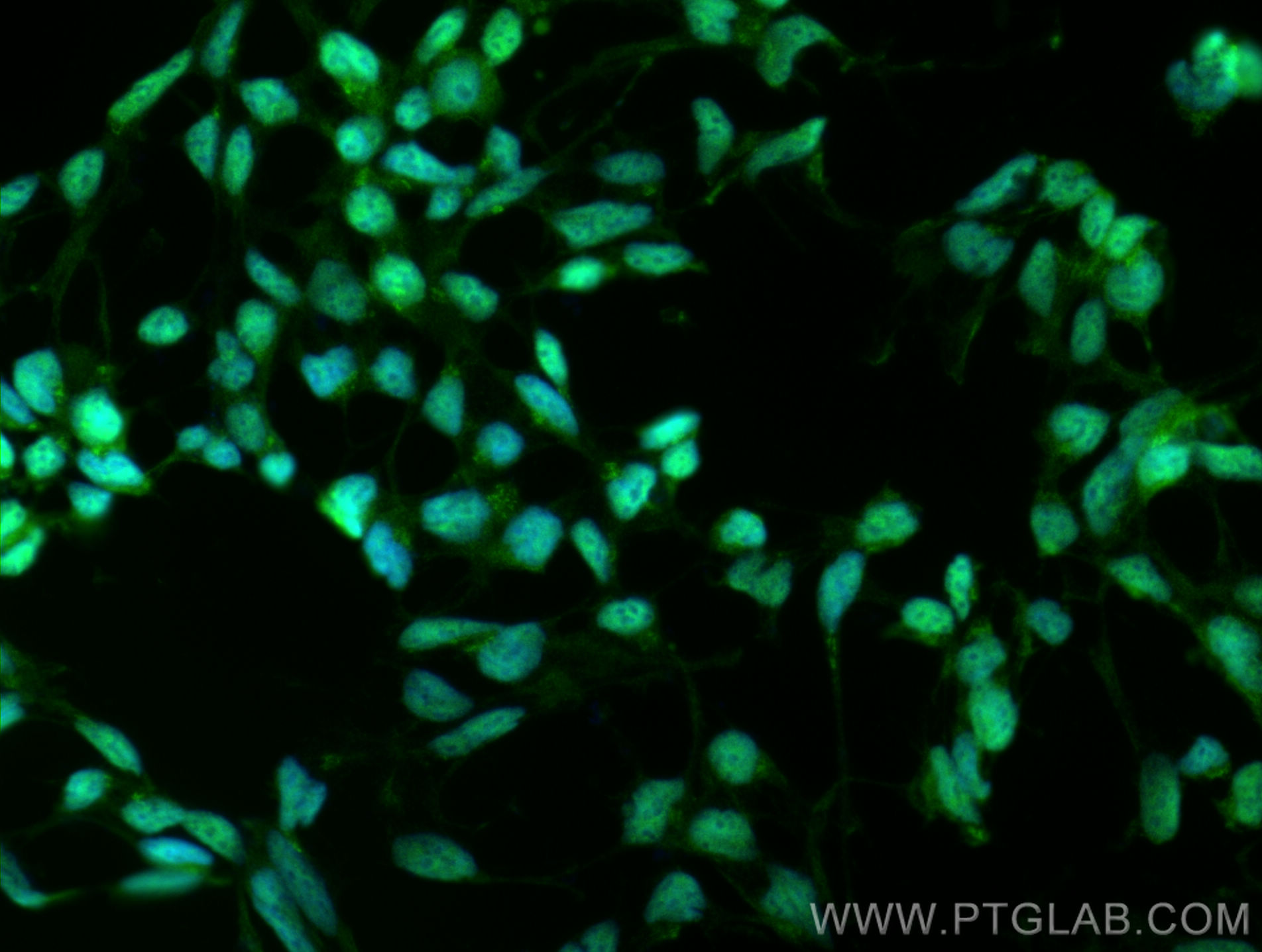 Immunofluorescence (IF) / fluorescent staining of HEK-293 cells using STK38 Polyclonal antibody (55335-1-AP)