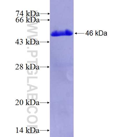 STK38 fusion protein Ag27382 SDS-PAGE