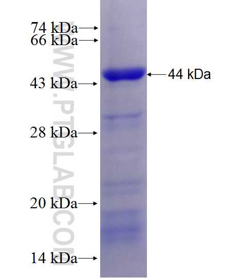 STK38 fusion protein Ag27873 SDS-PAGE