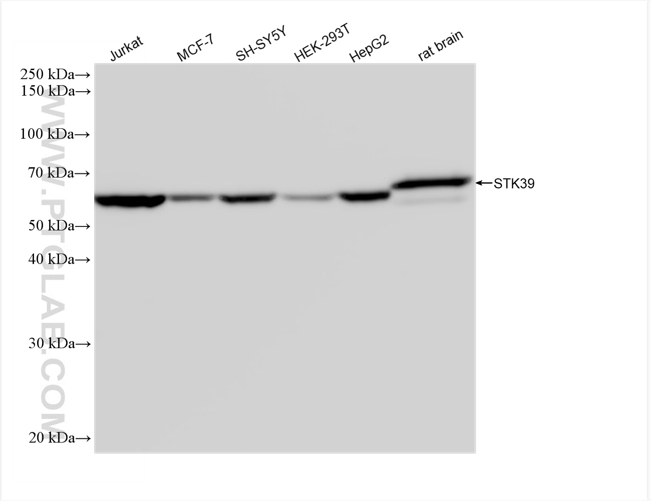 Western Blot (WB) analysis of various lysates using STK39 Recombinant antibody (83081-2-RR)