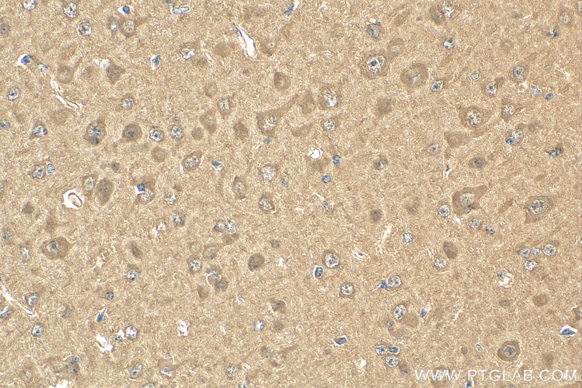 Immunohistochemistry (IHC) staining of mouse brain tissue using STK39 Recombinant antibody (83081-3-RR)