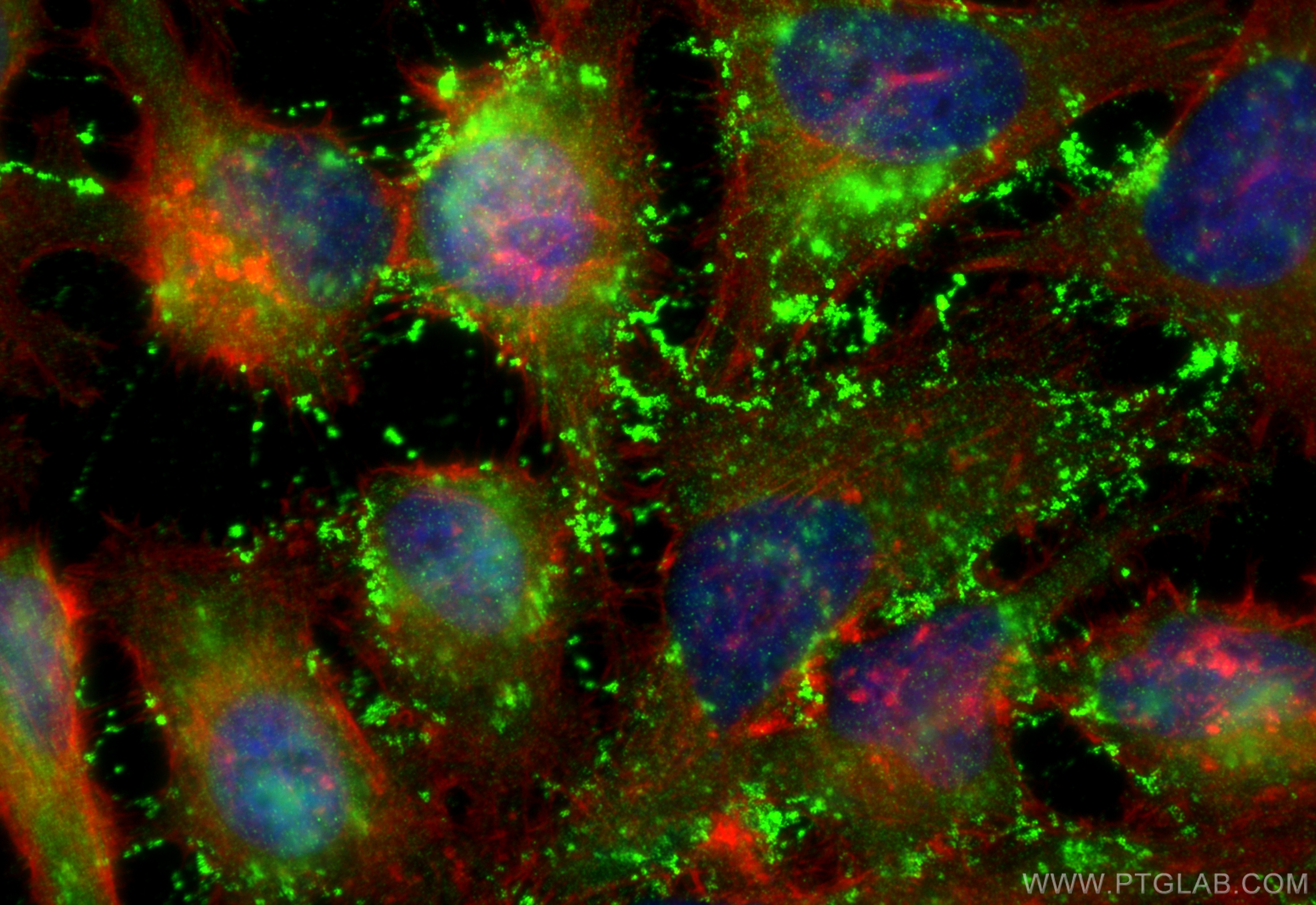 Immunofluorescence (IF) / fluorescent staining of HeLa cells using Stathmin 1 Polyclonal antibody (11157-1-AP)